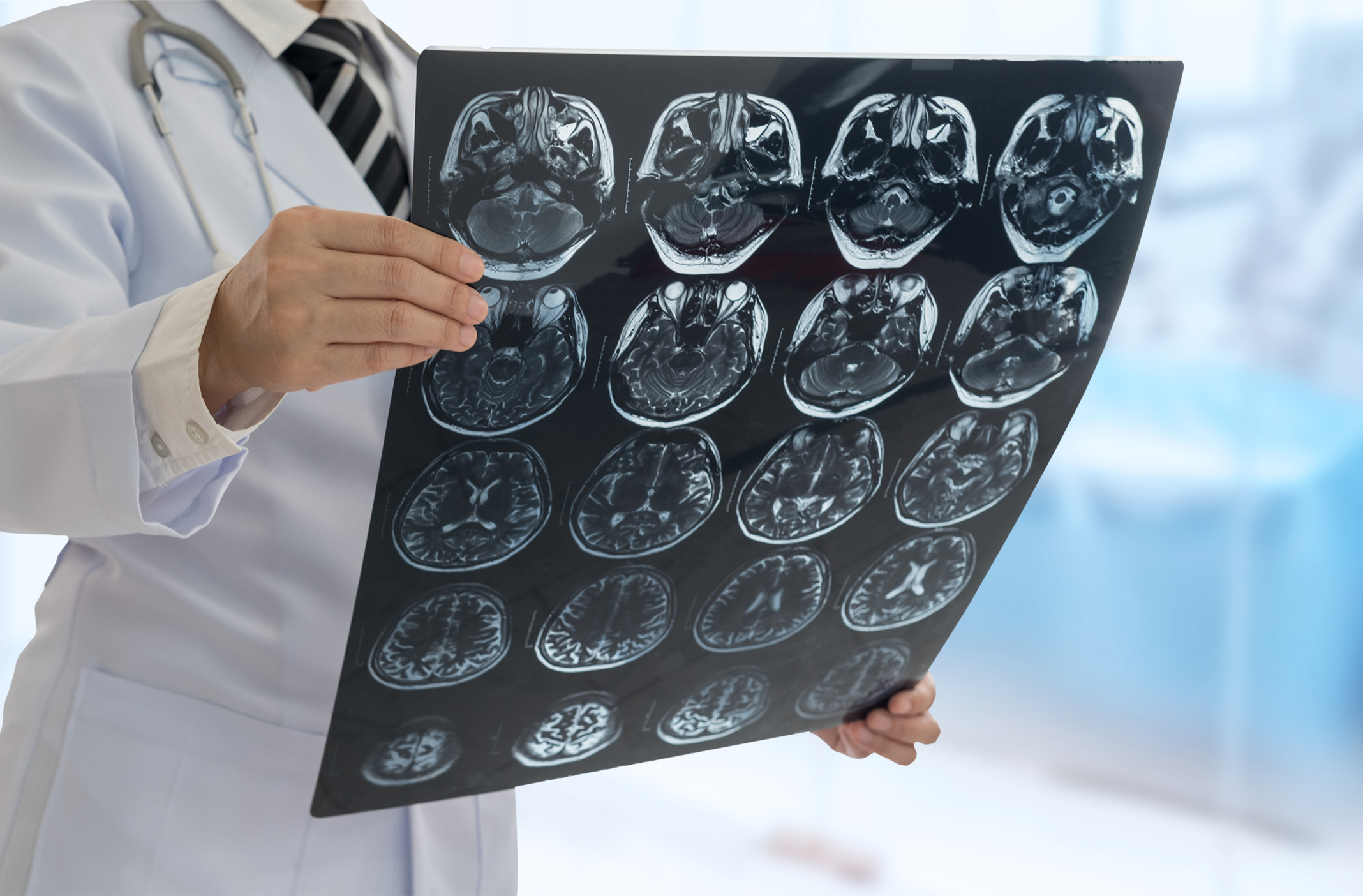 neurologia roma