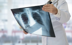 radiologia digitale roma