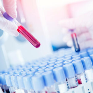 Laboratorio Analisi